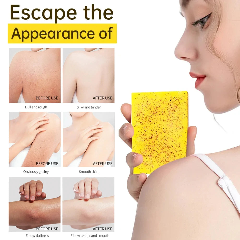 Zaidoc Kojic Acid Lemon Turmeric Soap Brightening Cleanser